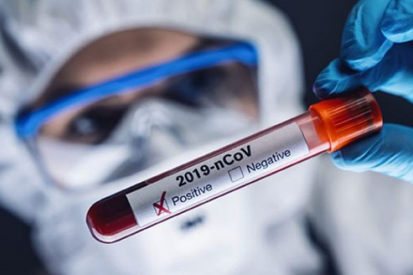 Azərbaycanda koronavirusla bağlı ŞAD XƏBƏR